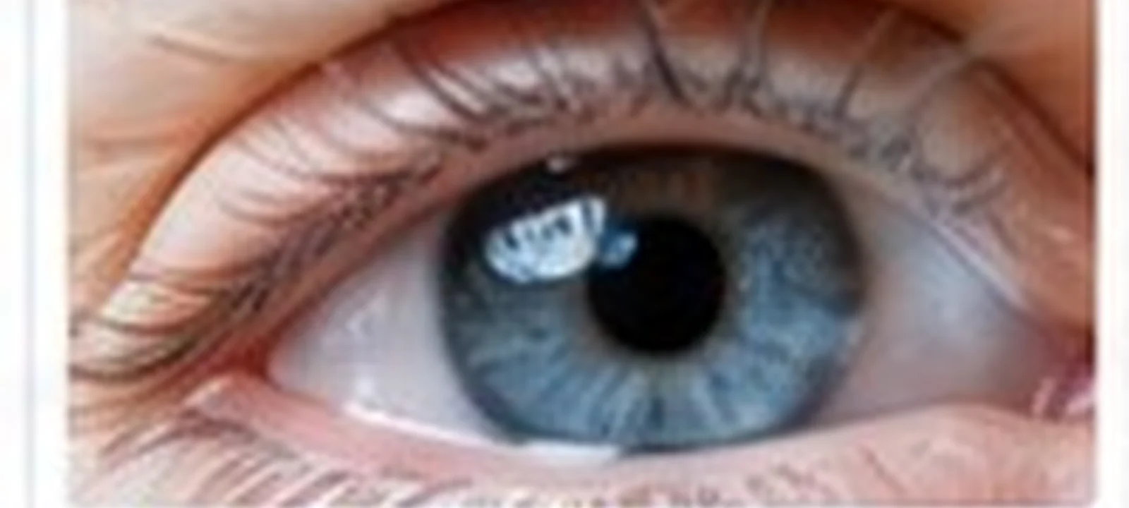 Cataract medical care in India