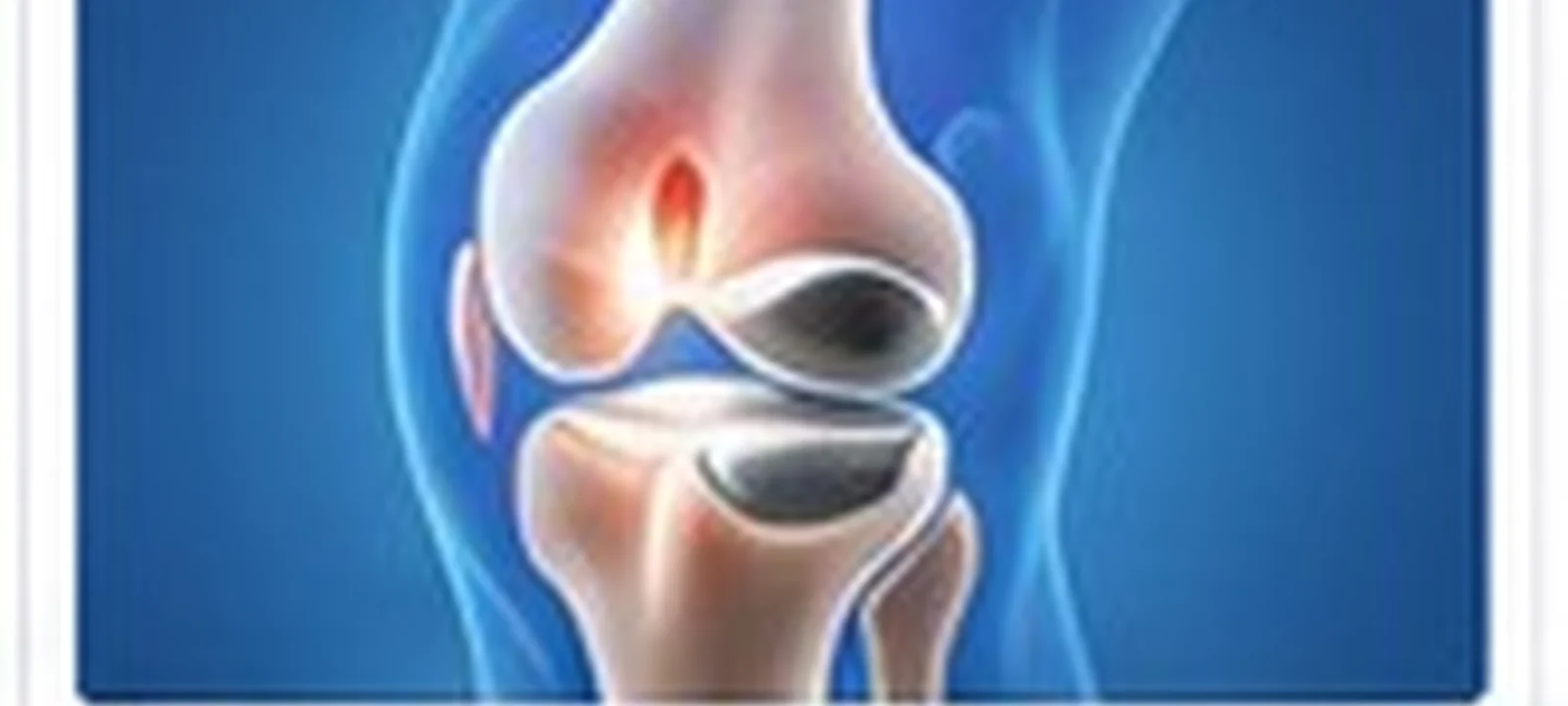 دليل المريض: Flying after joint replacement | Hospitals of India